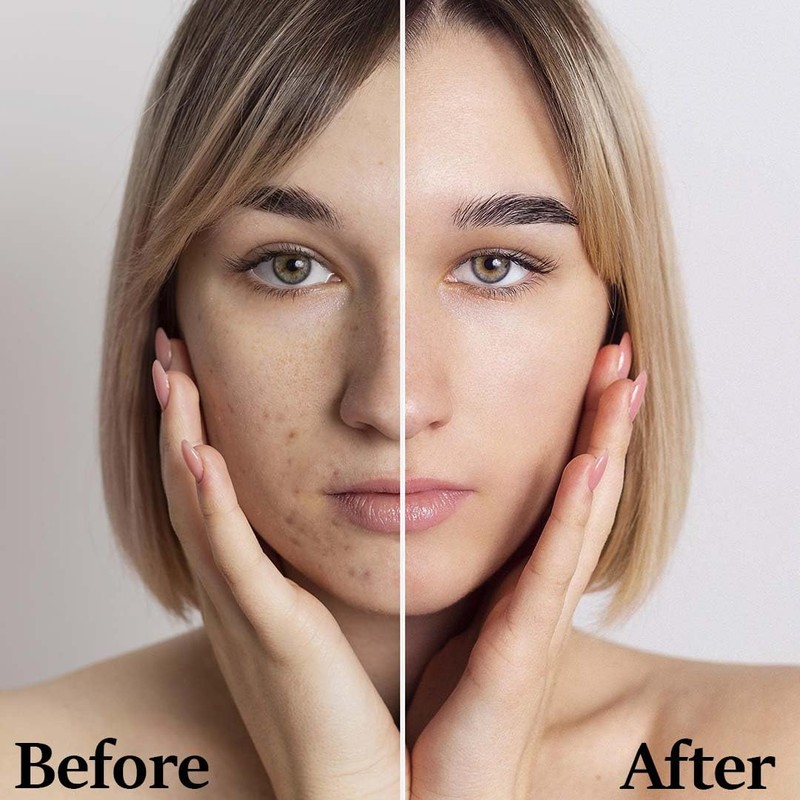 Aloe Vera Gel Powder 200x by mi Nature | Natural