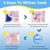 Milumber Teeth Whitening Strips for Sensitive, 42 Strips Whitener Safe