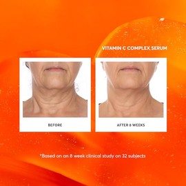 Suero facial con complejo de vitamina C, tratamiento facial antienvejecimiento con ácido hialurónico y vitamina E, 1 oz