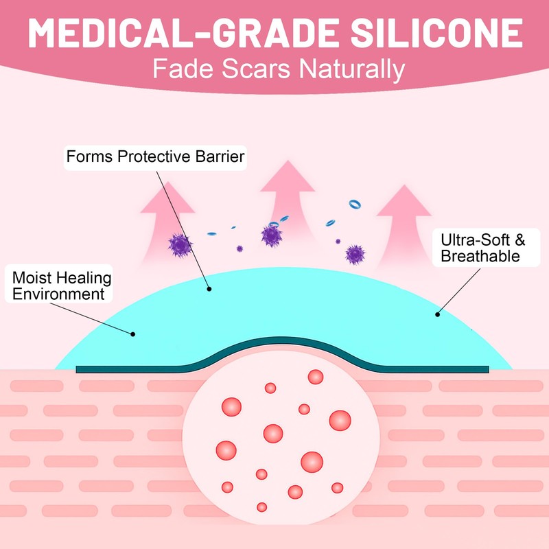 Silicone Scar Tape for Surgical Scars, Silicone Scar Sheets, C