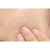 Kore Nadeshiko Moisturizing Peeling, Exfoliating Plug, Dullness, Poroporo Peeling Gel,