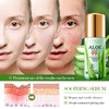 Aloe Vera Moisturizing & Soothing Serum, 40ml, improves the appearance