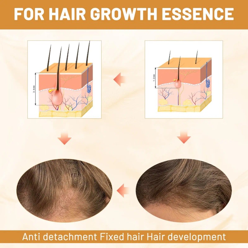 Sérum Capilar Douniu Con Agua De Arroz Para El Crecimiento