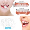 QincLing 2 Pairs of False Teeth Veneers, Temporary Teeth, Artificial