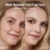 Red Light for Face and Neck, 7-in-1 Face Massager Tool