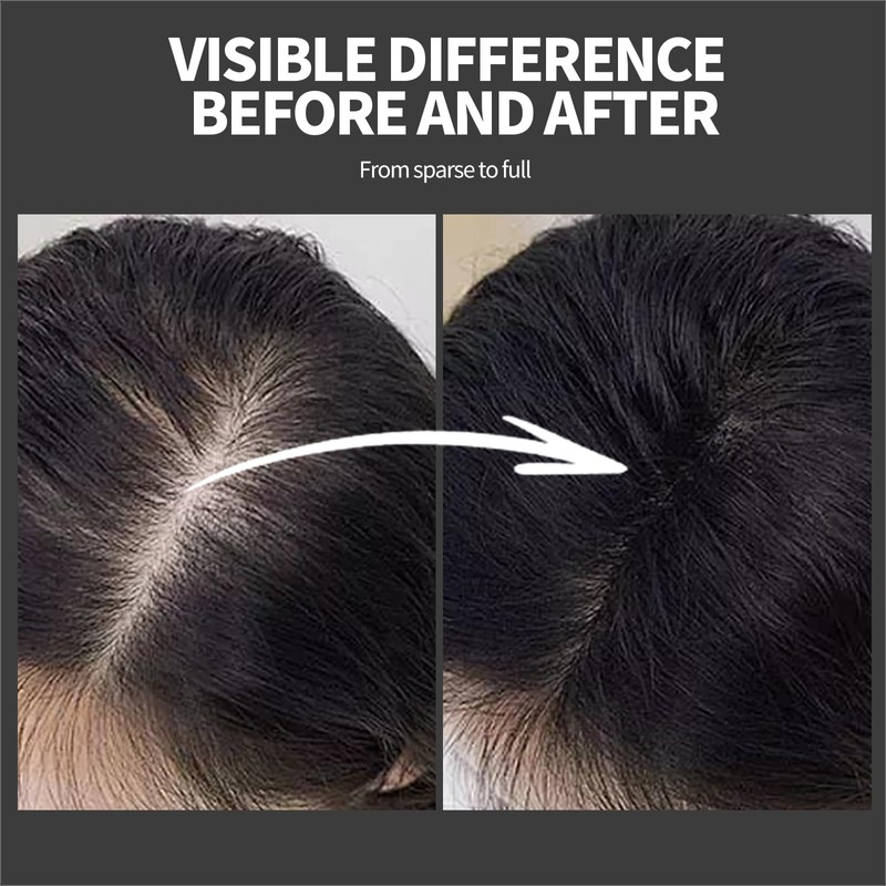 LEWEDO Hair Building Fibers - Instant Volume for Thinning Hair,