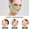 V-Line Lifting Chin Strap for Sleeping, Purely Physical and Side