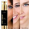 Prime9 Eye Cream for Dark Circles and Puffy Eyes| 60ml/2.02