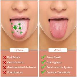 ACWOO Limpiador lingual, 3 unidades de raspador de lengua de acero inoxidable, juego de rascador de toungescraper de oro rosa para adultos, rascador para el cuidado bucal contra el mal aliento (oro