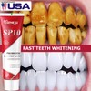 Unbranded Sp 10 Pasta Dental Sp-8 Ultra Whitening Sp10 Probiotic
