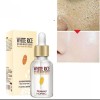 Serum Suave Blanquea Piel Aclara Suaviza Poros Moda Coreana Normal