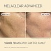 Isdinceutics Eco-Refill Melaclear Advanced - Dark Spot Corrector for Face