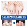 60 Parches Reparación De Uñas Nails Hongos