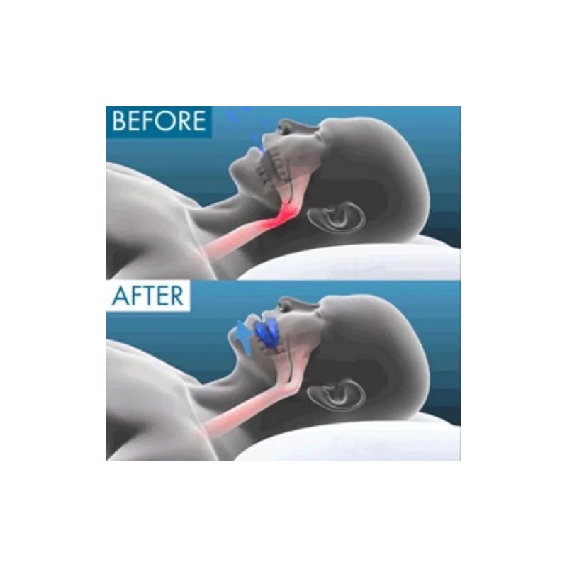 Boquilla Antirronquidos Honex