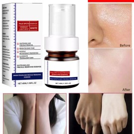 Unbranded Whiting And Freckle Removing Serum Cream Dark Spot Remover Freckle Cream Serum - 3Pcs