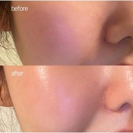 Fury Young Puriyoung LumiAge Elixir Booster 50ml PDRN Wrinkle Elasticity Whitening Moisturizing Anti-Aging / 퓨리영 루미에이지 엘릭서 부스터 50ml PDRN 주름 탄력 미백 보습 안티에이징