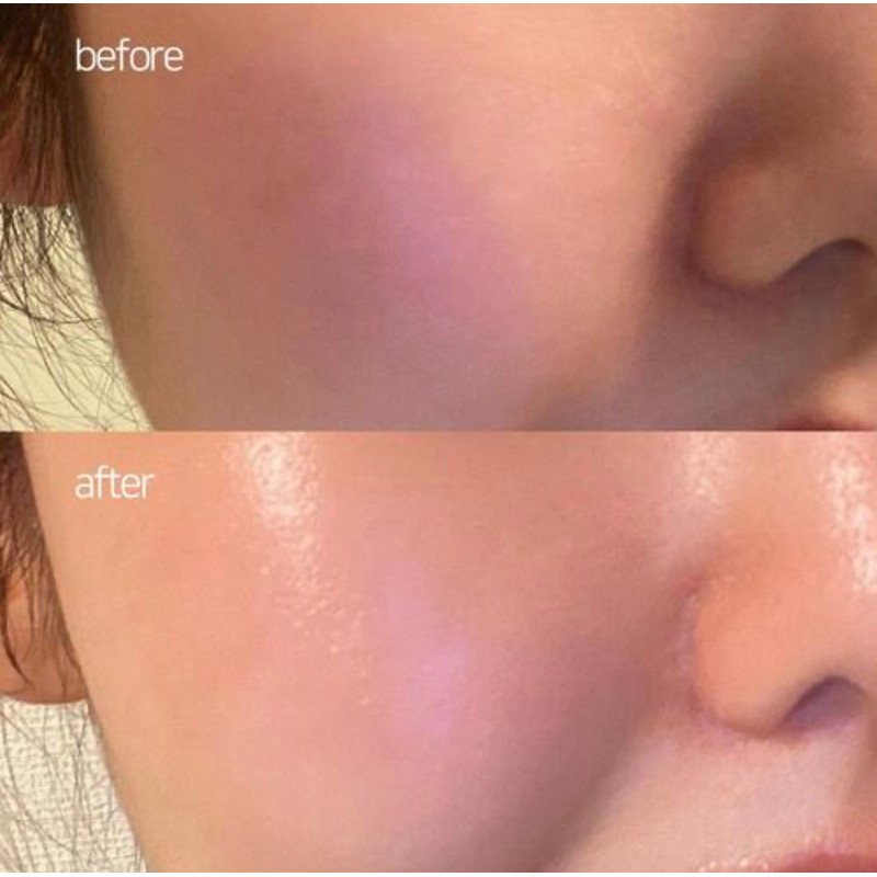Fury Young Puriyoung LumiAge Elixir Booster 50ml PDRN Wrinkle Elasticity