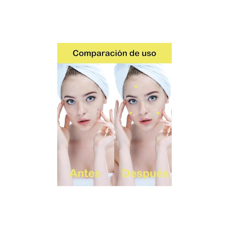 64 Tabletas Estrellas Para Granos, 2 Cajas, Rosa Y Amarillo,
