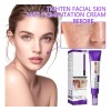 Crema De Hiperpigmentación Advanced Resist Para Iluminar El