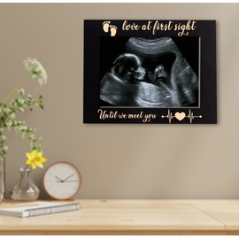 XJF Love at First Sight Sonogram Engraved Picture Frame, Gender Reveal Gift, Pregnancy Gift Photo Frame for Mother, Ultrasound Photo Frame for New Baby, New Dad & Mom Gift