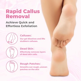 SAISZE Foot Callus Remover with Foot File, Extra Strength Callus Remover Gel with Brush Head, Professional Dead Skin Removal for Feet, 8oz