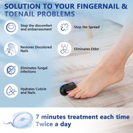 iKeener iKeener Nail Fungus Laser Therapy Device,Nail Laser Cleaning for Toenail Fingernails & Onychomycosis,Home Use Nail-Fungus Remover by 470nm Blue Light+660nm Red Light+905nm Infrared Light (Black)