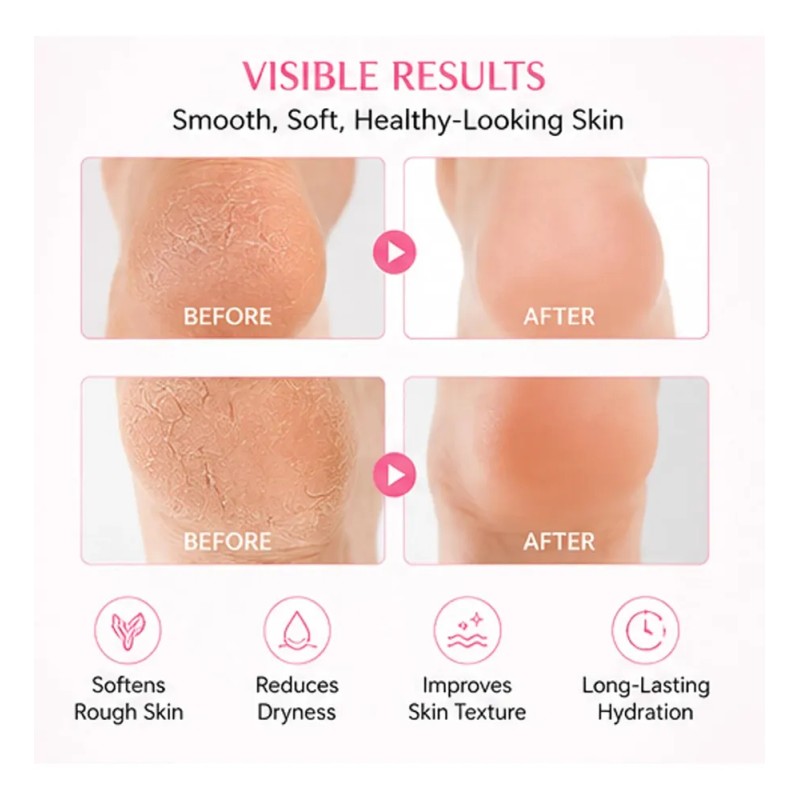 Sakura Foot Heel Stick, Sakura Scent Cracked Heel Repair