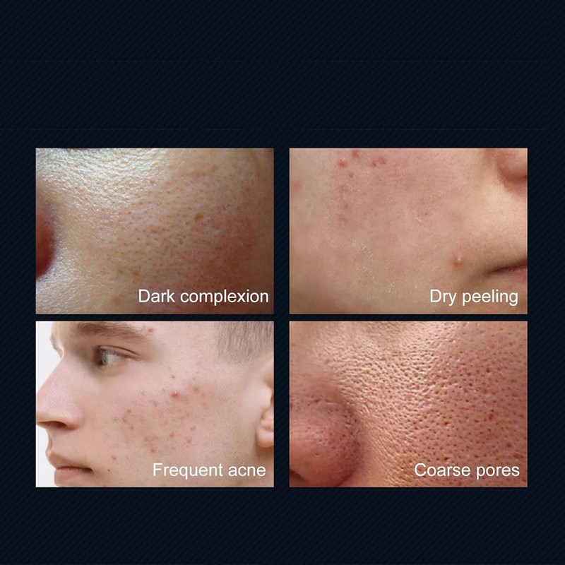 Crema Facial Matificante Para Hombre Tono Uniforme Y Control De