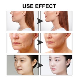 Chin Mask,Lift Chin Mask,Face Lift Tape,V Line Lifting Mask,Chin Lift Mask,Face Slimmer,Lifting Chin Mask,Skin Tightening Face Mask,Face Tape,Collagen Mask Face,Chin Lift Strap,Chin Contour Mask