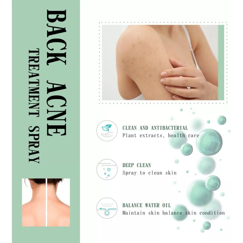 Ia Aj Cura El Acné De Espalda Con Ácido Salicílico