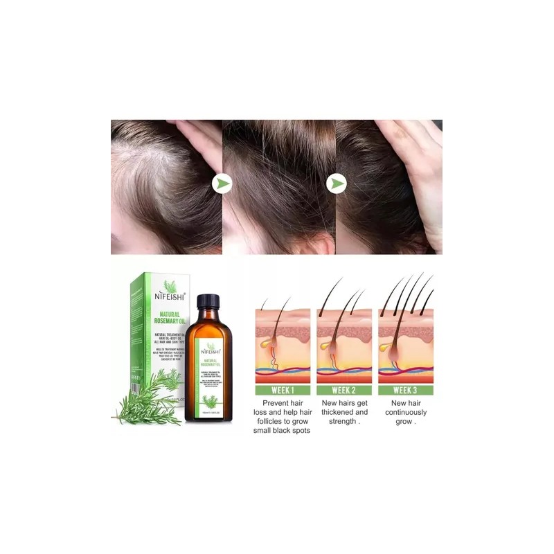 Aceite Fortalecedor Romero Cabello Pestañas Ceja 100 Natura