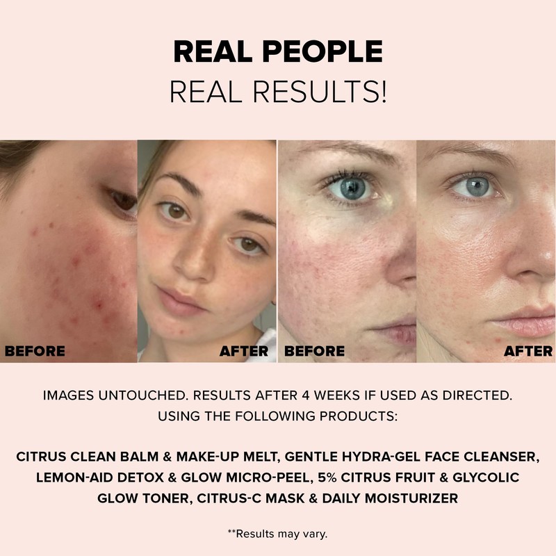 LEMON-AID DETOX & GLOW MICRO-PEEL