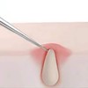 뾰족피지핀셋 초등학생블랙헤드 귀블랙헤드제거 겨드랑이피지제거 Sharp Pimple Tweezers for Elementary School