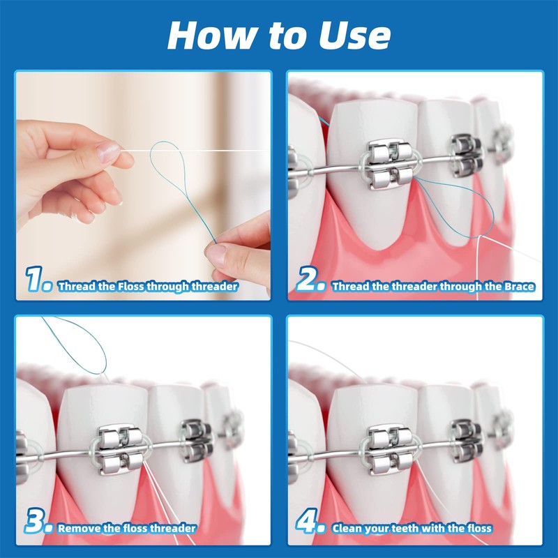 Kuvvfe Floss Threaders,Deep Clean Floss for Braces, Bridges, Implants|200Count (Pack