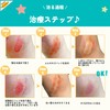Ikeda Mohando Muhi Wound Pads 10 Sheets