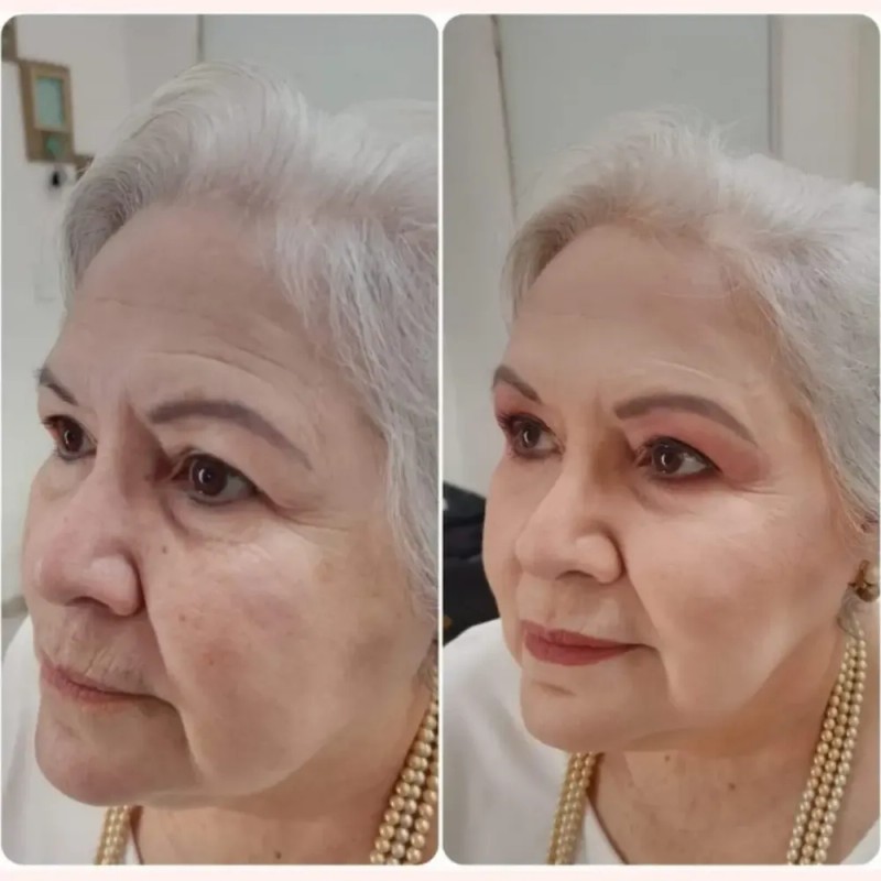 SVR Sebiaclear Active Gel Antiacné 40 ml para Piel Grasa