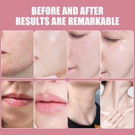 2PCS Nothora Collagen Wand, Nothora Collagen Stick, Portable Wrinkle Bounce Multi Balm, Multi-use Hydration Stick, For Face Lips Body, Suitable for All Skin Types