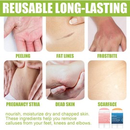 O'CHEAL Anti-Drying Crack Foot Cream Hand Cracks Repair Cream Body Cream Cracked Feet Removal Dead Skin Hand Feet Care Skin