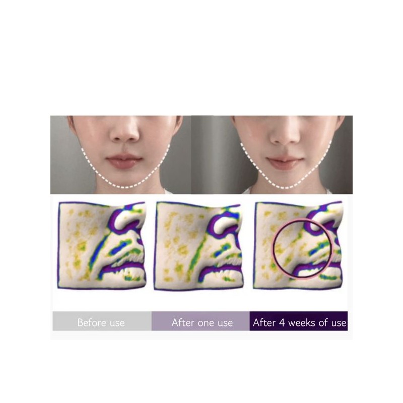 MEDITHERAPY Inmotox Tension Up Mask 28g*5ea