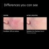 PCA SKIN Anti-Redness Serum, 1 fl. oz.