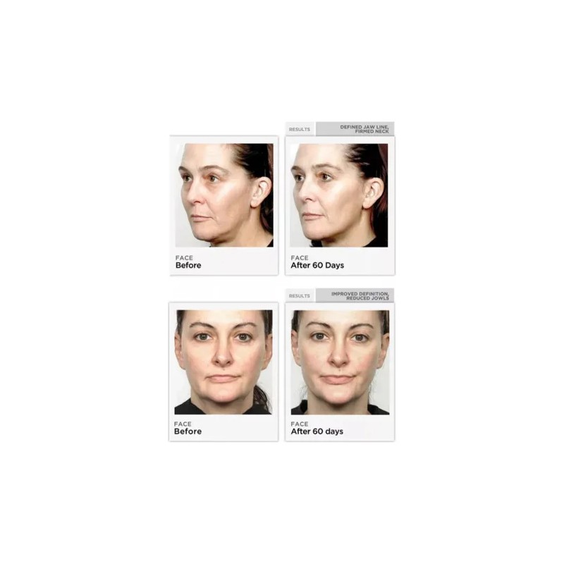 Tonificador facial microcorrientes + gel conductor 3×20 ml blanco, reafirma