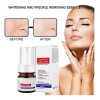 Serum Facial Whitening Y Freckle Eliminar Antiarrugas 40ml