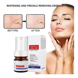 Serum Facial Whitening Y Freckle Eliminar Antiarrugas 40ml