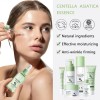 Set Mopoyat Kit Control De Acne Centella Asiatica