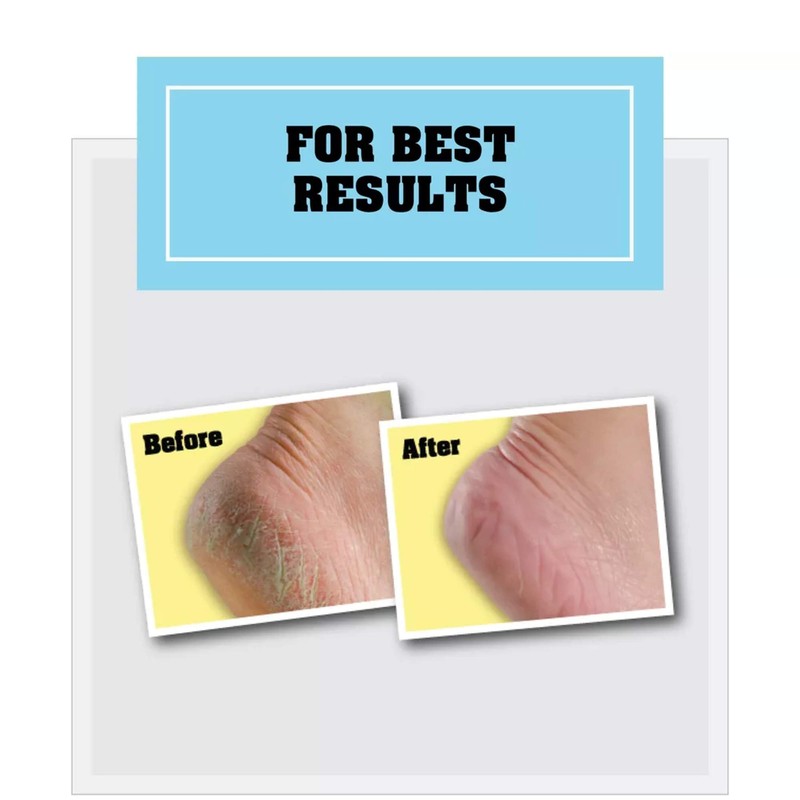 O Keeffe S Health Ft 2.7oz 4pk