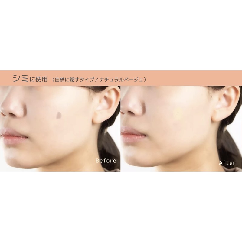Skin Seals, Naturally Hide (Seals for Stains and Acne Traces)