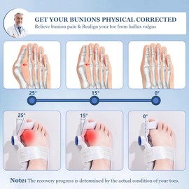 IvyWorkshop Bunion Corrector for Women Men Big Toe,Comfortable Toe Separators,Adjustable Knob Bunion Relief Orthopedic Toe Straightener with Bunion Silicone Pad,Suitable for Left and Right Feet(1PCS)