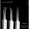 3PCS Ultra-fine Cell Pimples Clip Acne Tool Blackhead Zits Removal