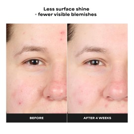 Paula's Choice Skin Perfecting 4% BHA Advanced Exfoliating Serum Toner Smooths the face with salicylic acid and antioxidants and anti-aging for skin texture Enlarges pores Unscented / 폴라 초이스 스킨 퍼펙팅 4% BHA 어드밴스드 각질 제거 세럼 토너 살리실산 및 항산화제로 얼굴을 부드럽게 하고 피부 결을 위한 안티에이징 모공 막힘 확대 무향