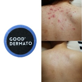 Good Dermato Mint for Decorte Body Bar (Buds back and chest body troubles! Back acne, millet, sun allergy, deep cleansing natural handmade soap wash), 115g, 1 piece, 1 piece / 굿더마토 Mint for 데코르테 바디바 (등가슴 몸트러블 싹! 등드름 좁쌀 햇빛알러지 딥클렌징 천연수제비누 워시), 115g, 1개, 1개입